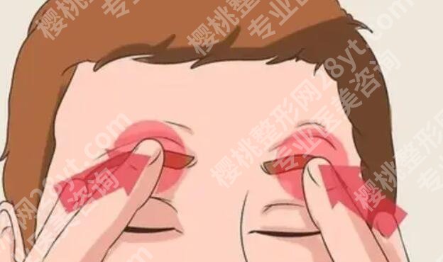 上海汪灏手术怎么样？医生口碑评价|除皱效果图反馈！