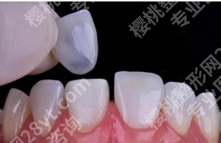 上海蓝阳口腔正畸多少钱?哪位医生技术可靠?特色项目介绍