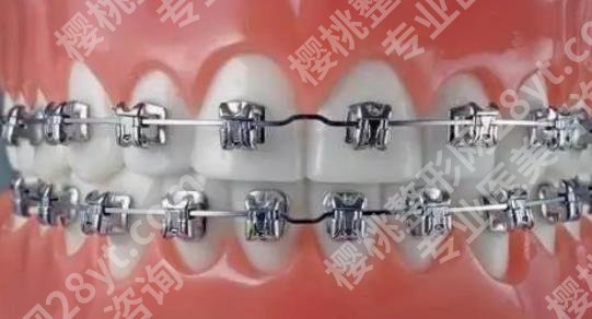 上海欧乐齐乐口腔门诊部效果好吗？医院开展项目有哪些？收费表