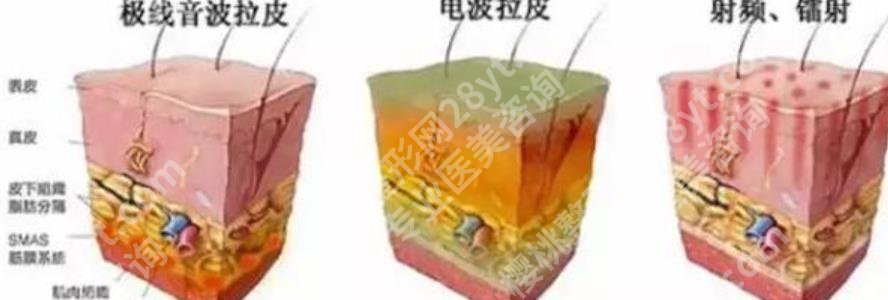 上海美姿整形抗衰怎么样？哪位医生技术好？抗衰案例曝光