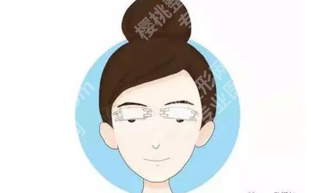 上海容妍医疗美容医院双眼皮价格贵不贵?收费标准是什么?案例参考