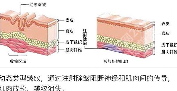 上海韩镜医疗美容医院除皱多少钱？医院简介及全新价格表一览