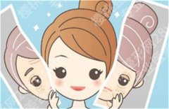 如何祛除脸上斑点？几个小方法，让你做无斑女人