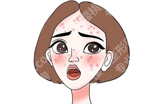 脸冻伤了怎么办？如何防止脸部冻伤？见一见戳进来