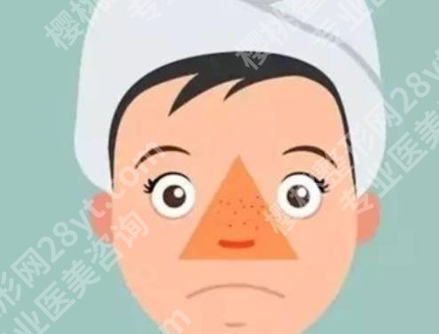 酒渣鼻的调节方法有哪些？酒渣鼻形成的原因有哪些？