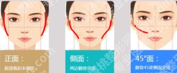上海做磨骨郑志雄和崔荣达哪个做的好？技术资质对比！案例参考