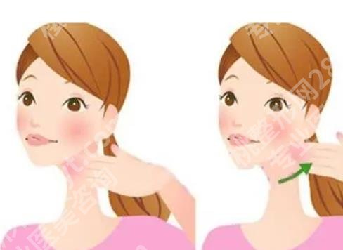 脸部抽脂手术多久消肿 ？脸部抽脂手术有风险吗？速速查看