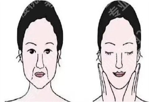 深蓝射频效果好吗？副作用怎么样？注意事项大全公布了