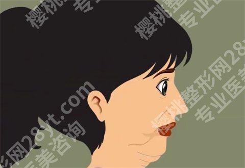 做完热玛吉注意事项整理了，热玛吉和超声炮哪个提升效果好？一并带你了解