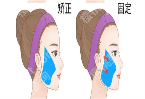 做热玛吉需要多长时间？可以除皱吗？进入查看内容解答