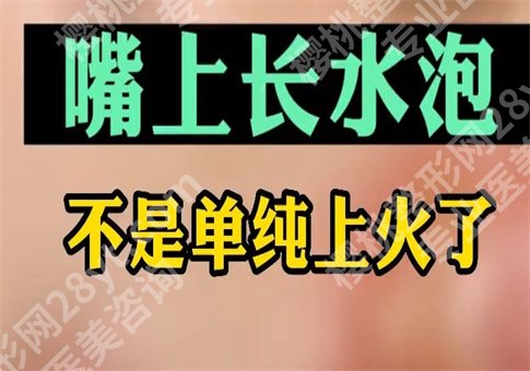 上火嘴唇起泡怎么办怎么快速消除？什么原因导致，整理多方面知识点