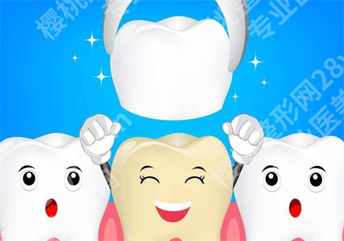 烤瓷牙寿命是多久？烤瓷牙和全瓷牙哪种好？全面解析