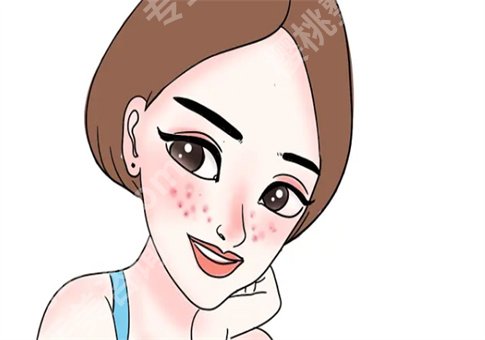 脸上有痘印怎么办？激光调节痘印效果怎么样？小方法及手术形式都已解答