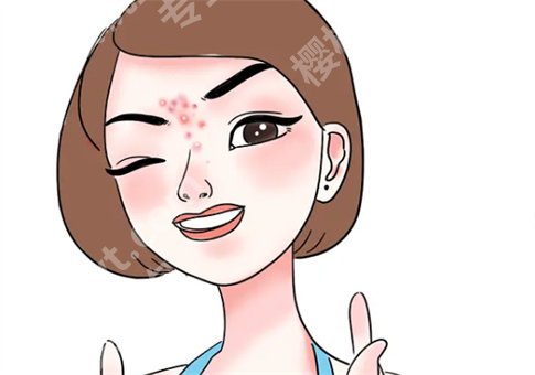 脸上有痘印怎么办？激光调节痘印效果怎么样？小方法及手术形式都已解答