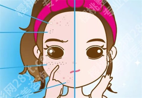 如何淡斑祛斑小妙招？分享解决斑点的方法，有斑点者的福音来了