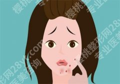 下巴长痘痘是什么原因？饮食该吃什么？集合解答