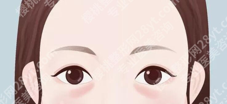 卧蚕填充需要多少钱？有什么注意事项吗？戳进来了解一下吧