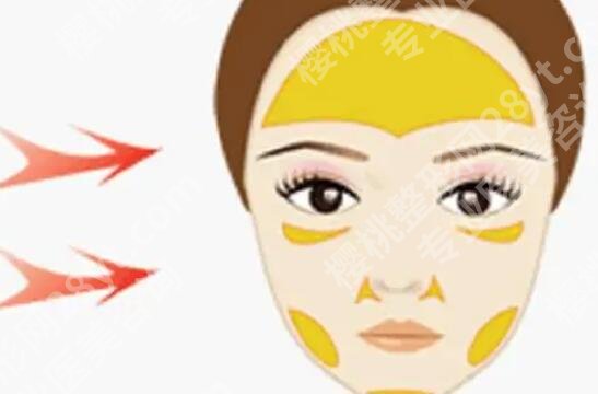 面中凹陷是什么原因呢？术后如何护理呢？收藏再看！