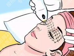 口周年轻化整形美容的常用方法有哪些？光子嫩肤、注射玻尿酸等效果都不错！