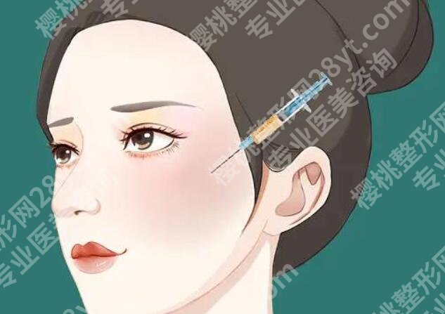 表情区能做脂肪填充吗？术后如何护理？来看详细介绍