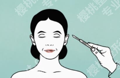 苹果肌下垂法令纹深做什么医美？皮肤护理、填充等效果都不错！