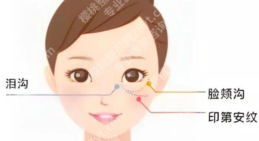 脸部提拉紧致手术多少钱？注意事项汇总！收藏再看！