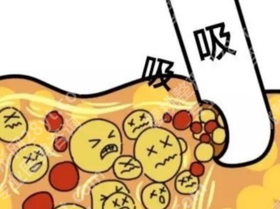 吸脂凹凸不平多久恢复？原理是什么？戳进来看！