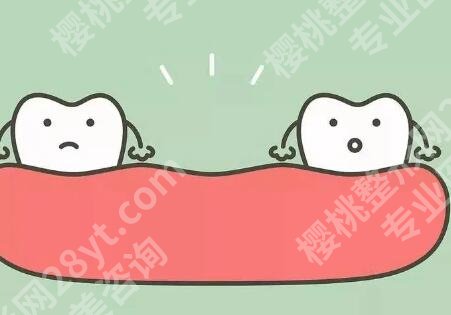 拔烂牙多少钱一颗啊?牙齿的大小以及调节的复杂程度都应该考虑!