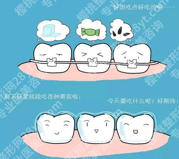 补一颗门牙正常价格要多少?不要为了省钱而牺牲质量!