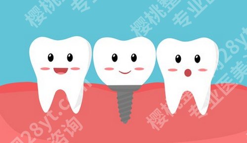 广州种植牙费用是多少？费用还涉及到牙种植手术的费用！