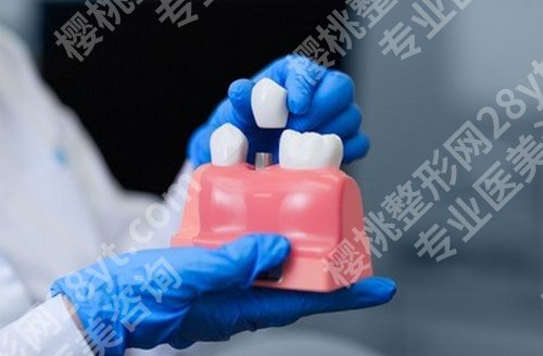 韩国种植牙登腾和奥齿泰哪个好？两个都是韩国知名的种植牙品牌！