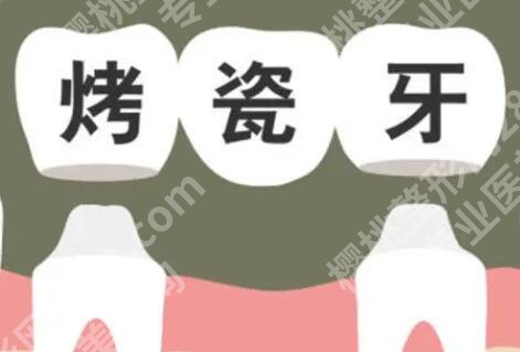 烤瓷牙崩瓷了是质量不好吗？选用了高质量的瓷材料和严谨的技术操作很重要！