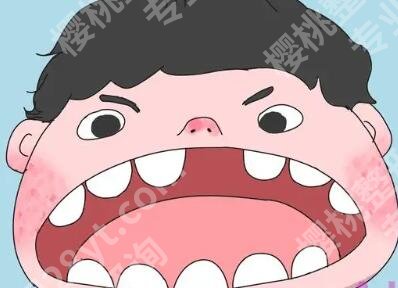 烤瓷牙崩了一块可以修复吗？烤瓷牙具有修复牙齿的外观和功能！
