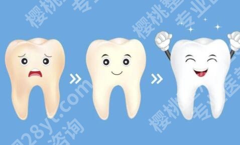 烤瓷牙齿是什么材质？这种方式的优点是具有较高的强度和稳定性！