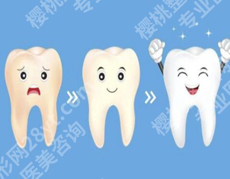 烤瓷牙是由什么材料组成？带来美丽的笑容和良好的咀嚼功能！