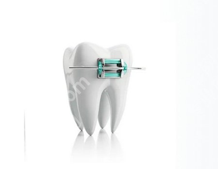 门牙有缺口怎么修复？修复后的牙齿表面光滑平整！