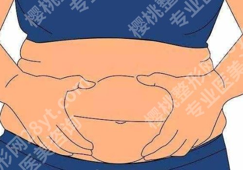 腰腹环吸有什么风险和后遗症？这些事你真的知道吗？