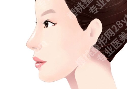鼻翼缩小修复怎么样?术前应该做好哪些准备?
