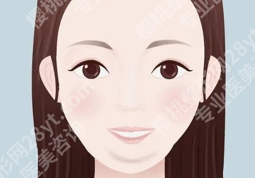 苹果肌凹陷怎么改良？三种热门方式，利弊等介绍！