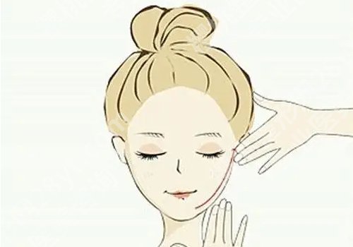 下颌线提升前后对比（案例）更新，术后脸型更显精致！