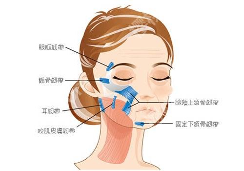 外轮廓固定提升打什么针？玻尿酸、胶原蛋白等都是不错的