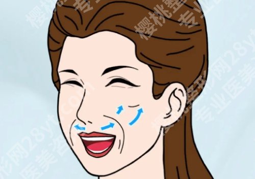 外轮廓固定提升打什么针？玻尿酸、胶原蛋白等都是不错的