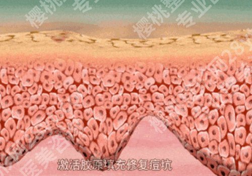 毛孔粗大的原因有哪些？有什么调节方式？