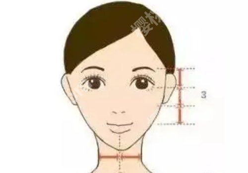下颌角肥大多少钱？费用明细、注意事项预览！