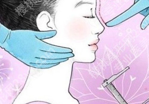 宝尼达隆鼻可以维持多久？详情科普攻略一览