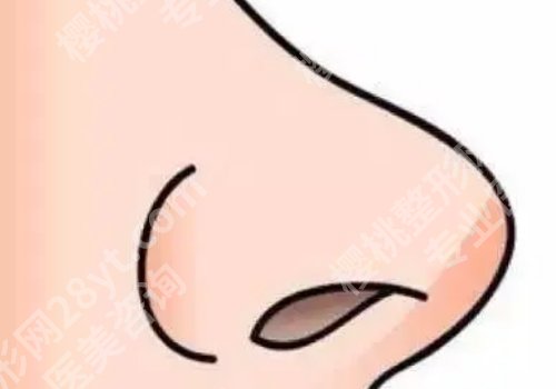 宝尼达隆鼻可以维持多久？详情科普攻略一览