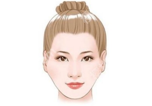 颧骨高有什么办法改良？术前科普大盘点！