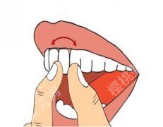 缺一颗牙是镶牙好还是种牙好？种牙和镶牙哪个方式好？