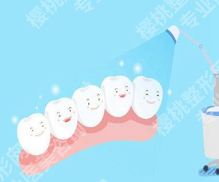 如何去牙石的简单方法？看看相关的去牙石方法吧！