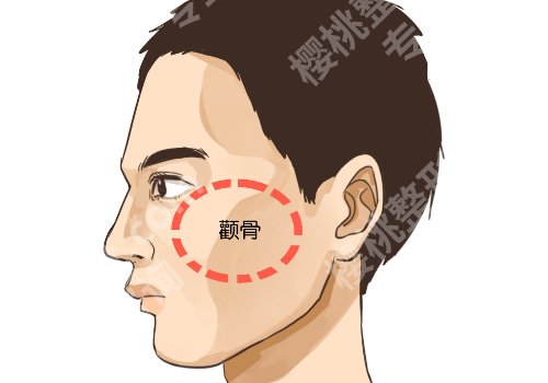 颧骨高怎么改良脸型？原来这样也可以？